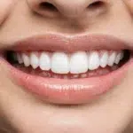 como blanquear los dientes remedios caseros